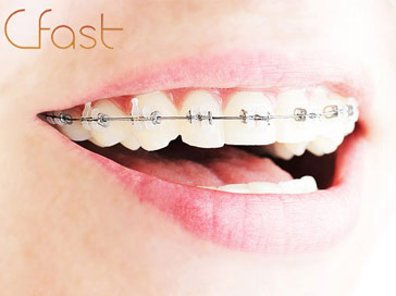 cfast brace