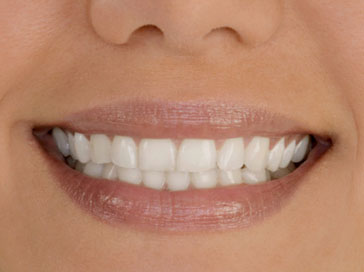 cosmetic dentistry dentures