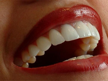 cosmetic dentistry braces