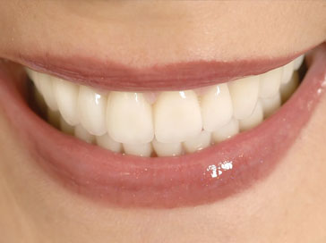 cosmetic dentistry whitening
