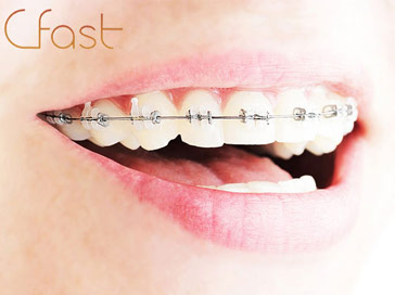 cfast tooth alignment liverpool