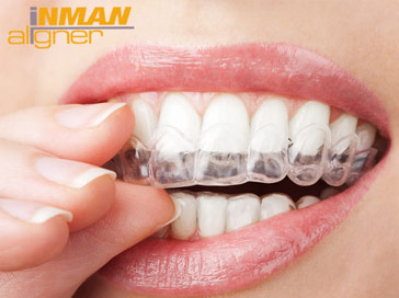 inman aligner brace liverpool