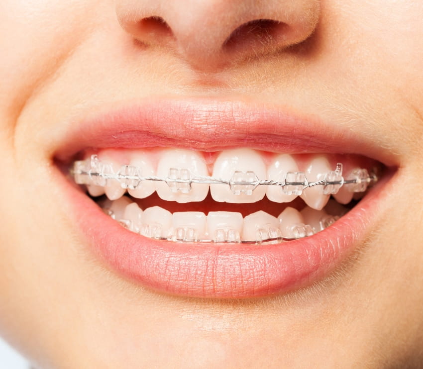Khan Dental