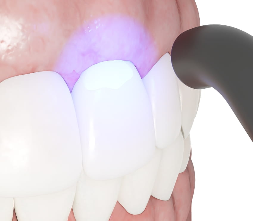 Khan Dental