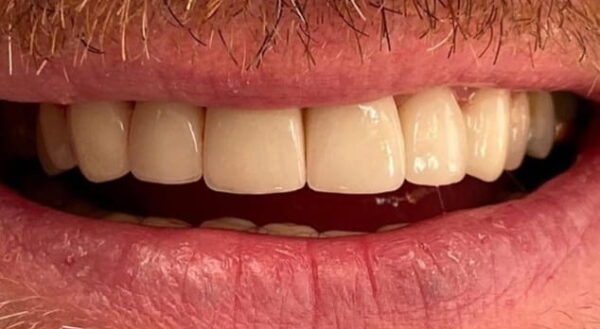Khan Dental