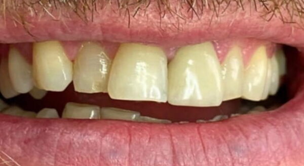 Khan Dental