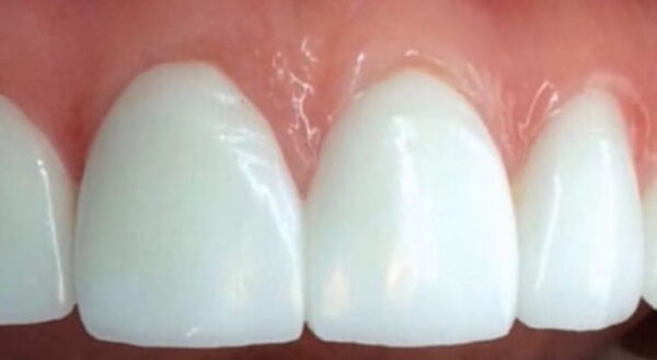 Khan Dental