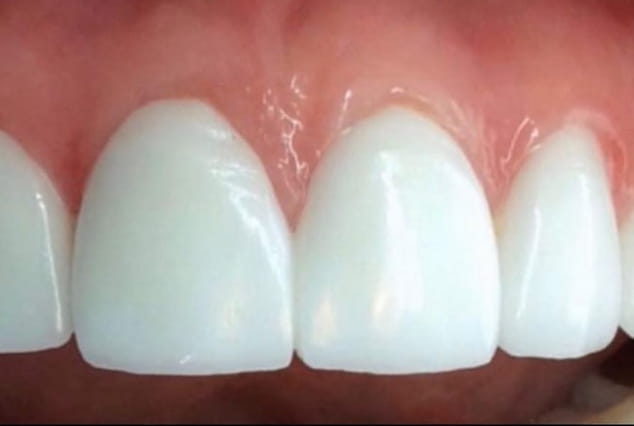 After - Khan Dental