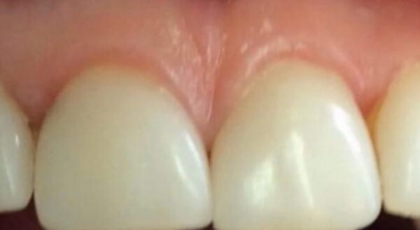 Khan Dental
