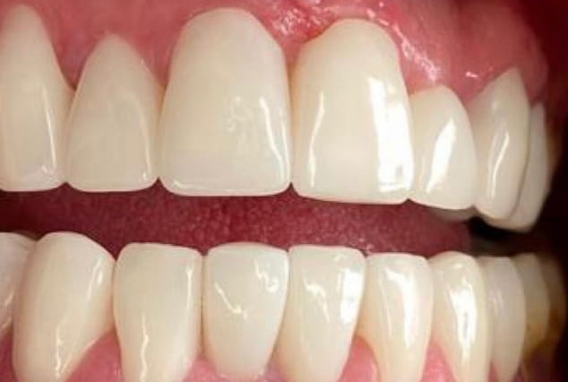 After - Khan Dental