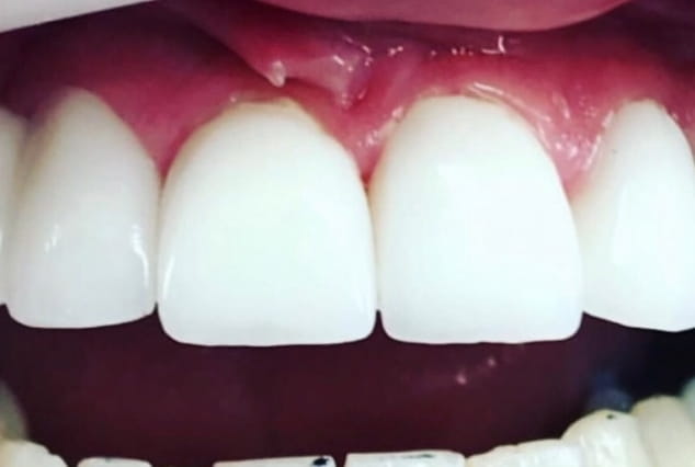 After - Khan Dental