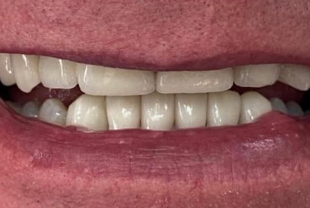 After - Khan Dental