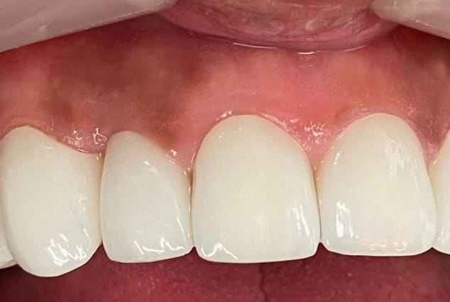 After - Khan Dental
