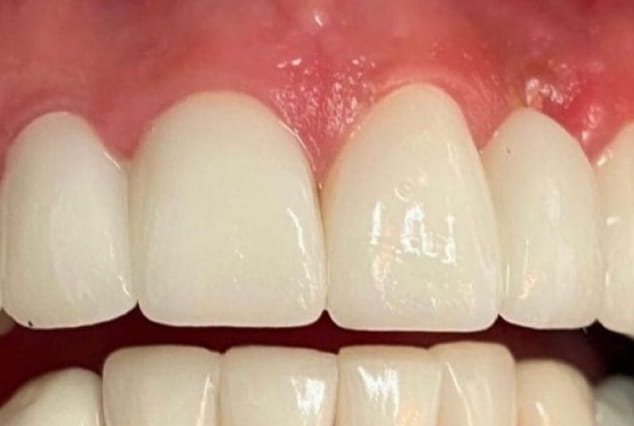 After - Khan Dental