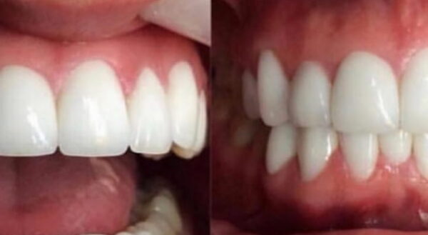 Khan Dental