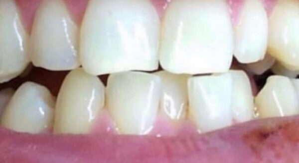 Khan Dental