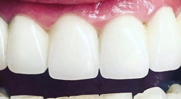 Khan Dental