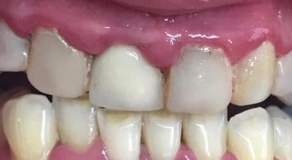 Khan Dental