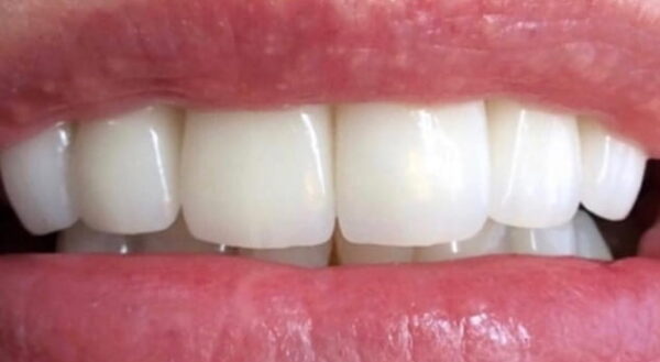 Khan Dental
