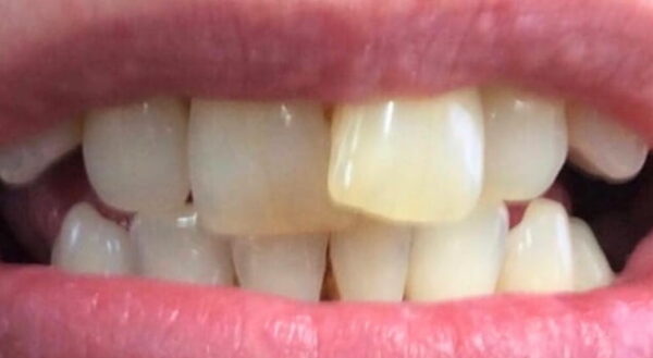 Khan Dental