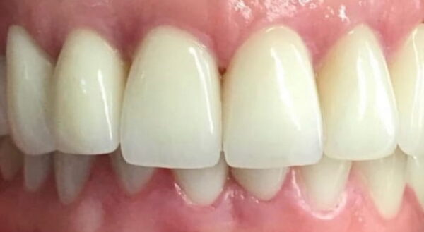 Khan Dental