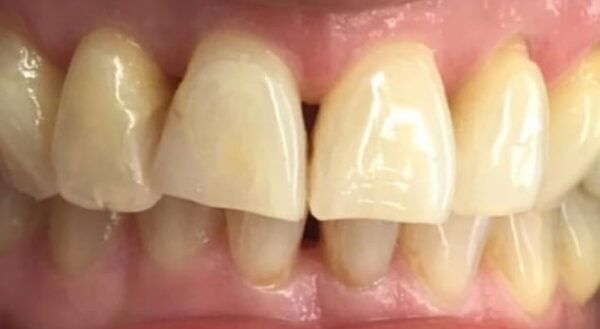 Khan Dental