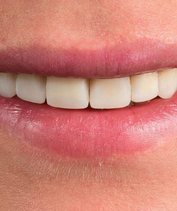 Treatments - Khan Dental
