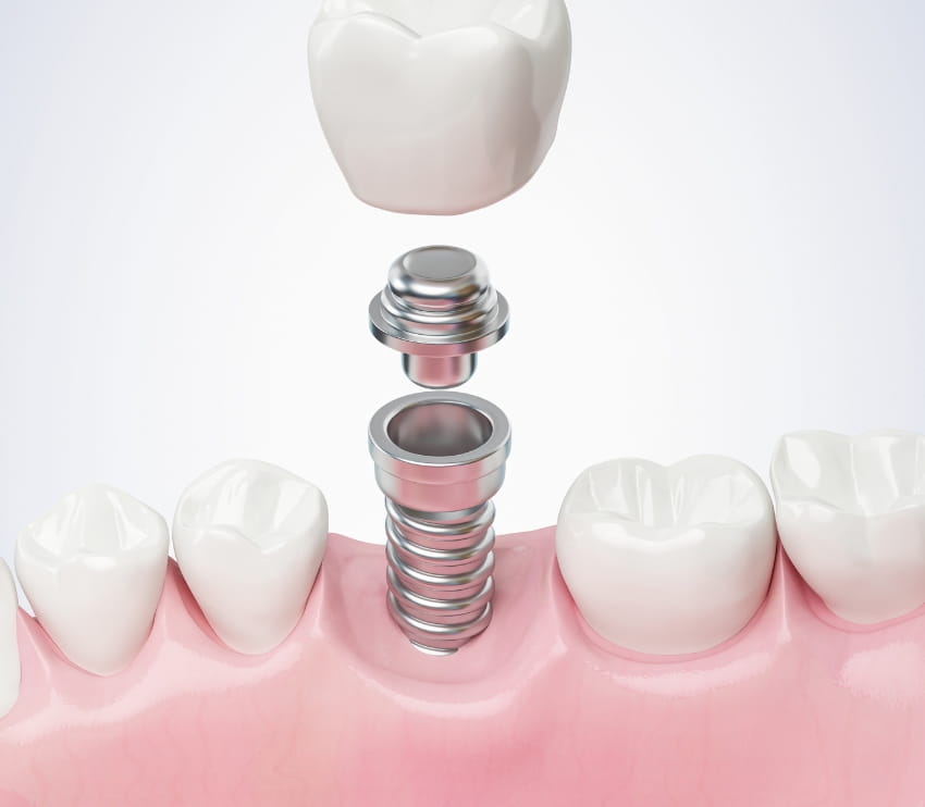 Khan Dental