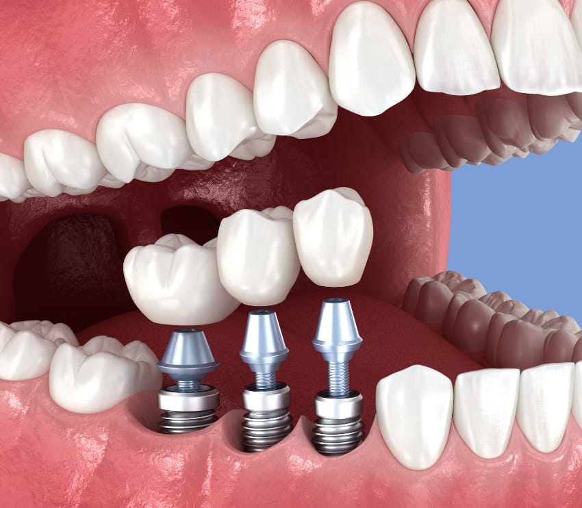 Khan Dental