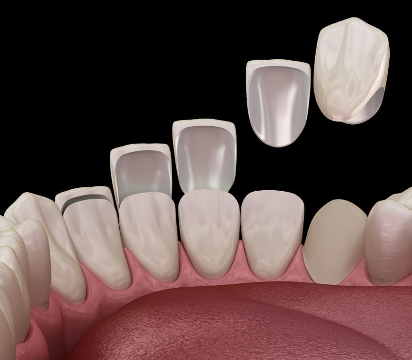 Khan Dental