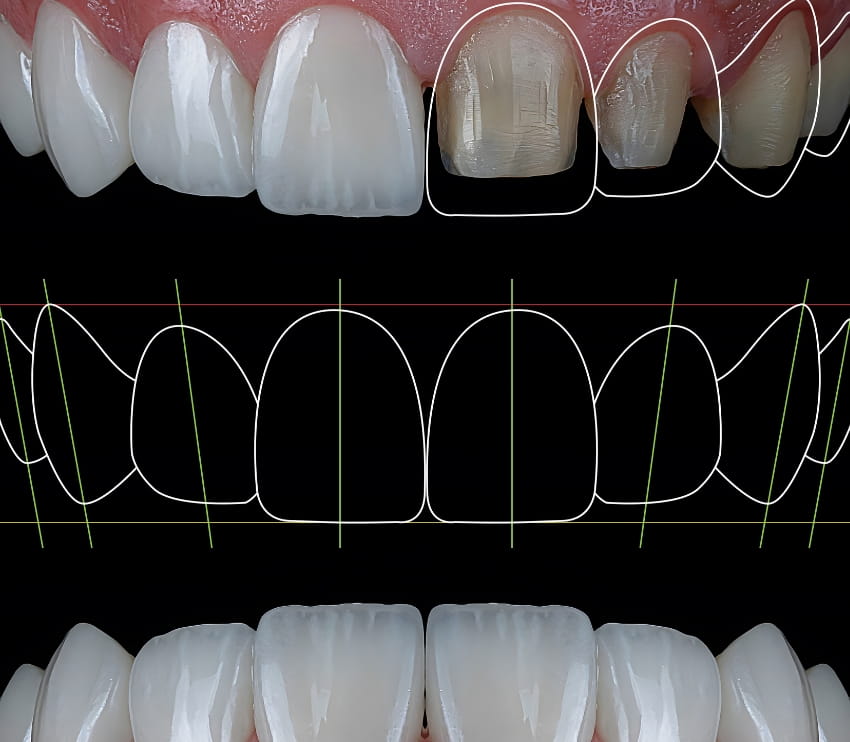 Khan Dental