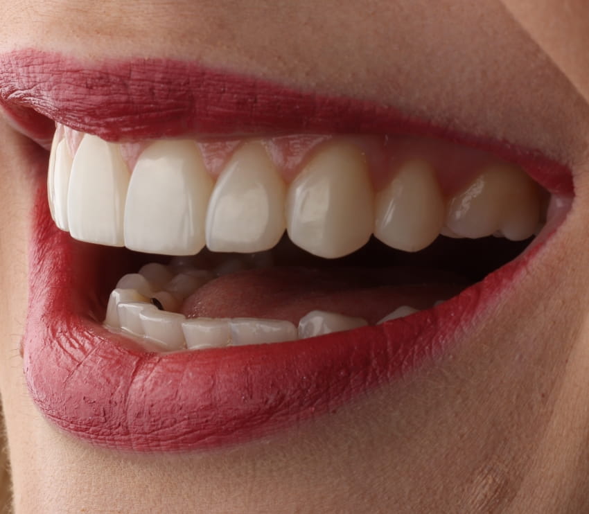 Khan Dental