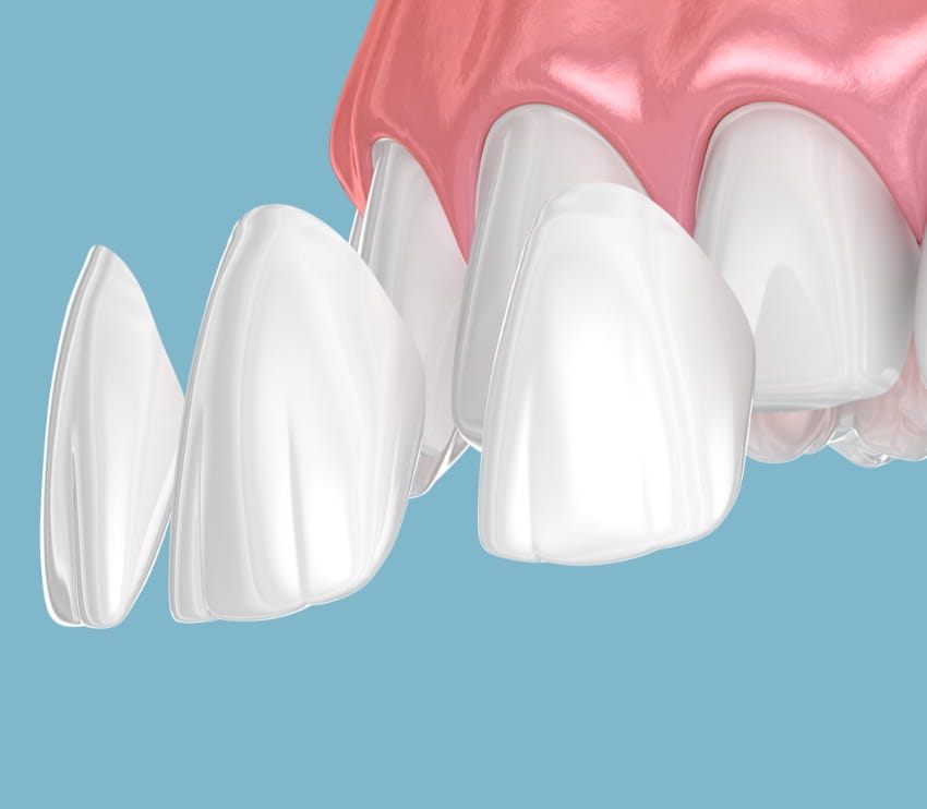 Khan Dental