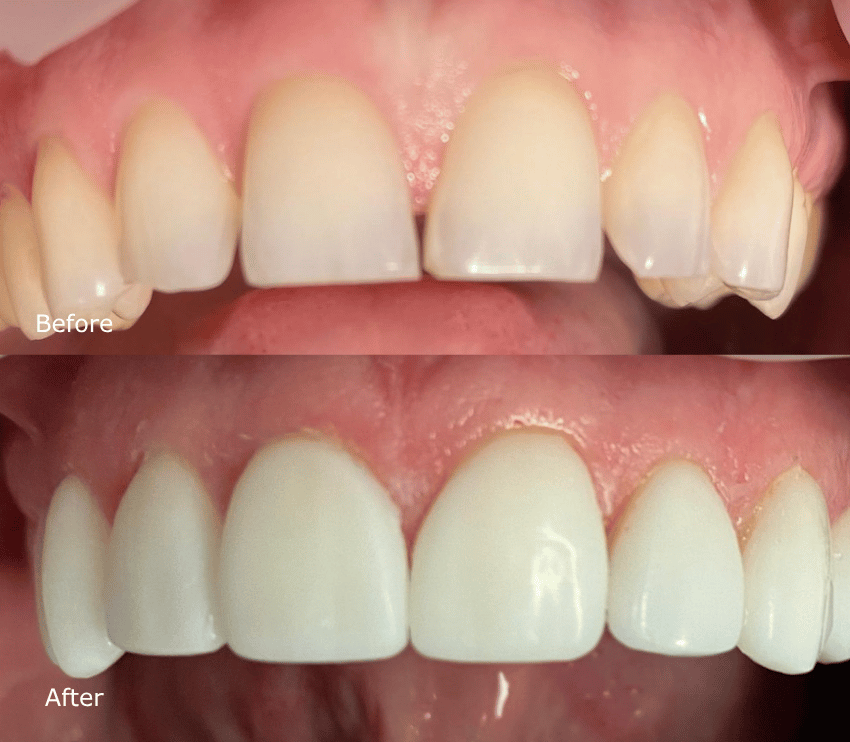 Khan Dental