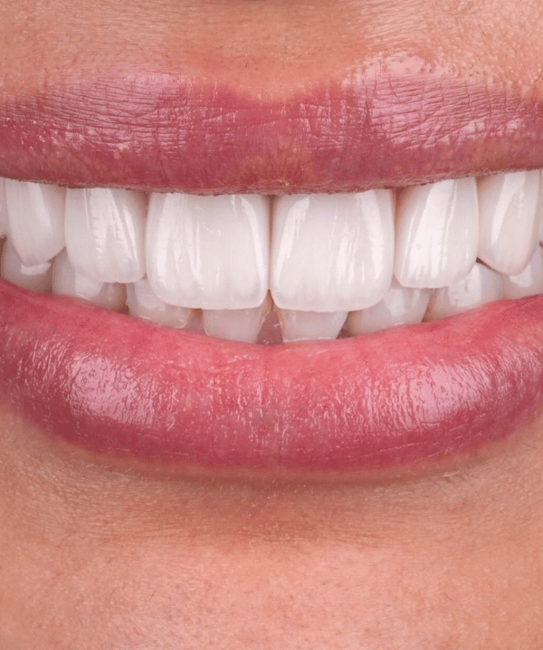 Treatments - Khan Dental