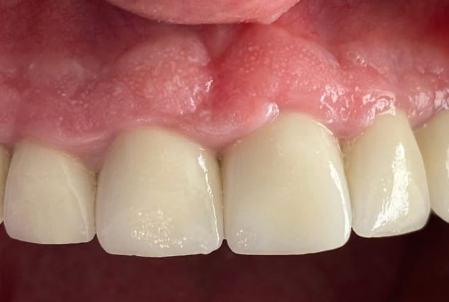 After - Khan Dental